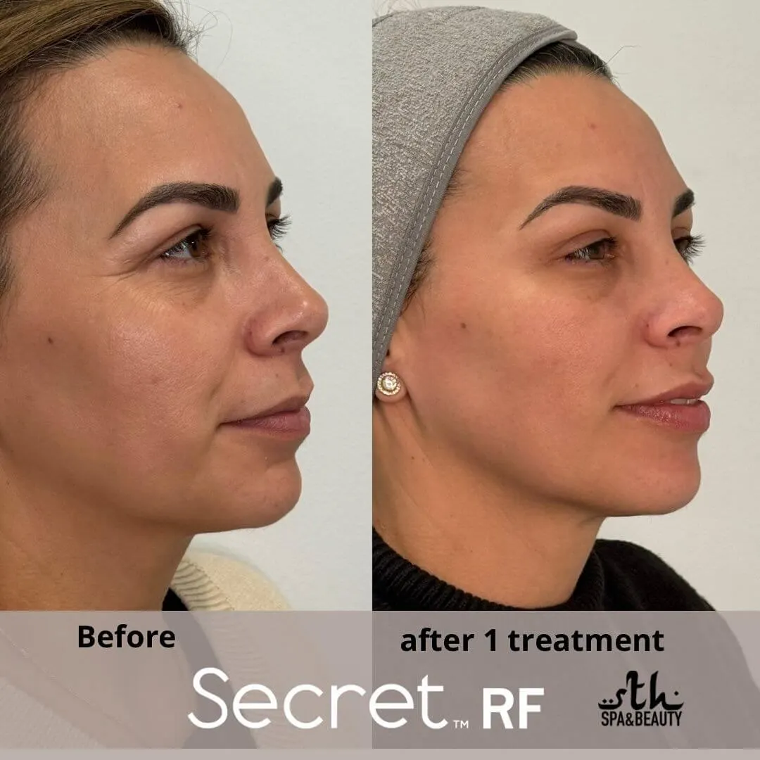 Treatment result